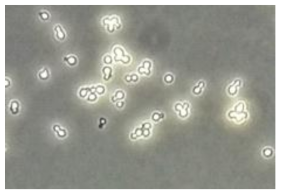 mating된 yeast cell