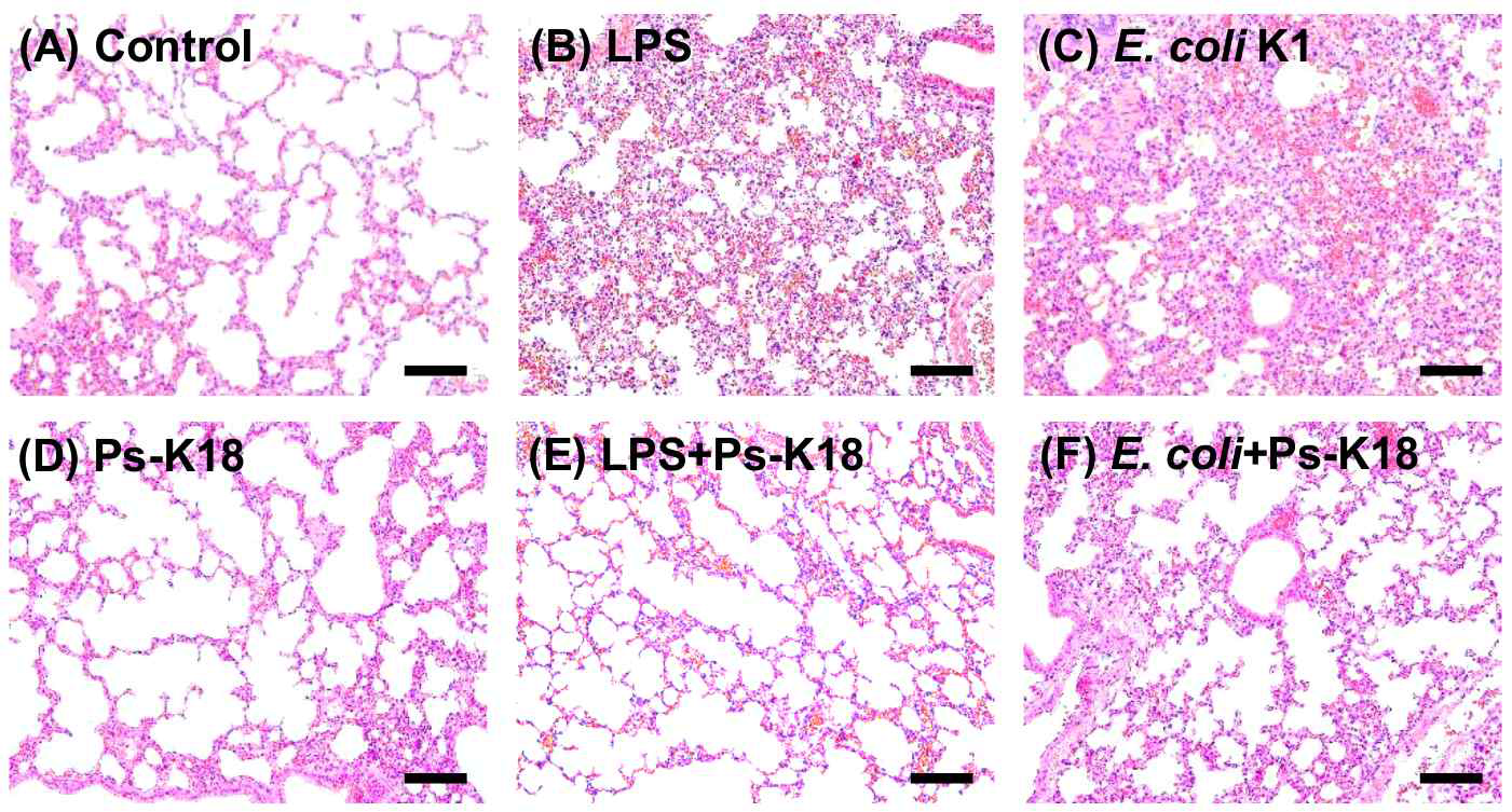 Lung morphology 로 본 Ps-K18의 폐 침윤 염증 세포 억제능 Lung morphology (A) control, no peptide treatment, (B) LPS (15 mg/kg), (C) E. coli K1 (1 × 106CFU/mouse),(D) Ps-K18 (1 mg/kg), (E) LPS + Ps-K18, injected with both LPS and Ps-K18, and (F) E. coli K1 + Ps-K18