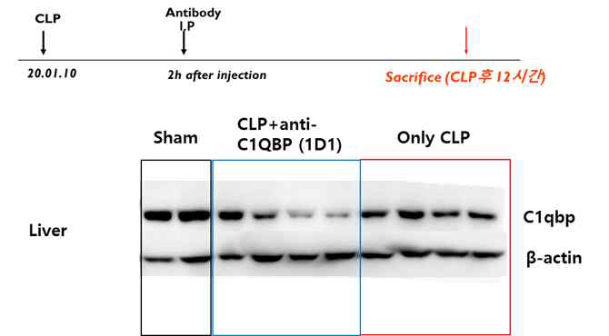 항체 1D1에 의한 Liver C1QBP 발현의 감소