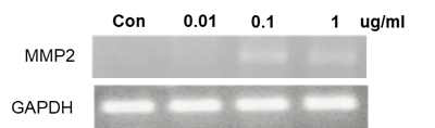 재조합 C1QBP 처리시 MMP2 유전자 전사체의 발현 변화