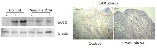 Smad7 억제에 의한 EGFR 발현 저하