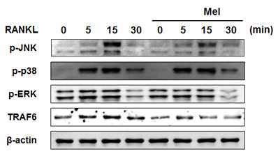 파골세포 분화시 Melatonin에 의해 조절되는 JNK 인산화와 TRAF6