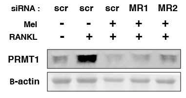 파골세포 분화시 Melatonin receptor와 PRMT1 발현의 관련성