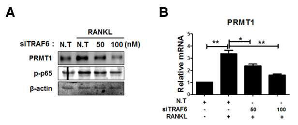 파골세포 분화시 TRAF6에 의해 조절되는 PRMT1