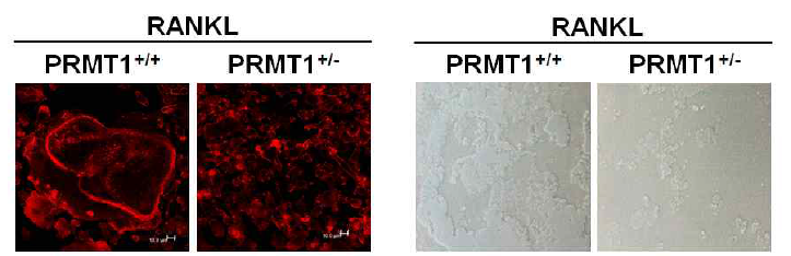 분화된 파골세포 F-actin ring 염색 및 골 흡수 평가 결과 이미지