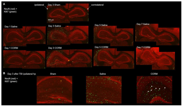 외상성 뇌손상 이후, NeuN과 Ki67의 발현을 hippocampus에서 확인. (A) Day 1, 3, 5, 7에서 Saline 그룹과 CORM 그룹에서 확인. (B) SLM (stratum lacunosum-moleculare, 화살표)에서 Ki67 발현이 CORM day 3에서 증가함을 확인