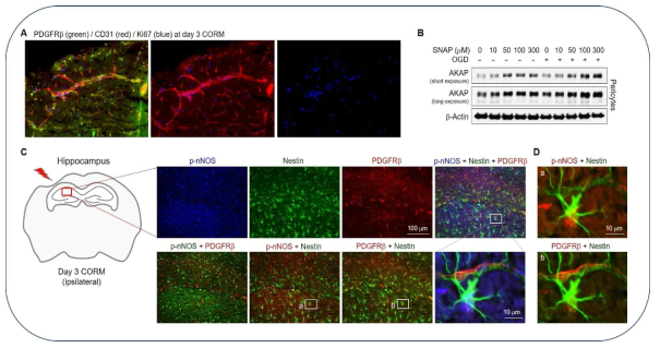 외상성 뇌손상 이후 CORM 투여 뇌에서 혈관신생과 신경줄기세포 증식이 관찰됨. (A) Day 3 에서 CORM 투여한 ipsilateral 부분에서 혈관의 세포분열이 관찰됨. 이는 혈관내피세포마커(CD31)와 세포분열마커(Ki67)로 확인함. (B) NO donor인 SNAP을 농도별로 처리하자, AKAP 단백질 발현이 증가함. (C-D) CORM 투여 마우스 뇌의 ipsilateral hippocampus에서 nNOS의 활성을 확인. 이때 신경줄기세포(Nestin)의 핵에서 p-nNOS가 발현함을 확인. 또한, 신경줄기세포와 혈관주위세포가 근접하여 위치하고 있음을 관찰