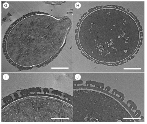 TEM micrographs of Kirengeshoma koreana (G, I) and Kirengeshoma palmata (H, J). Scale bars 5 ㎛ in G, I, and 2 ㎛ in H, J