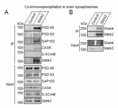 Slitrk2-PDZ 도메인 단백질 상호작용 분석 (in vivo)