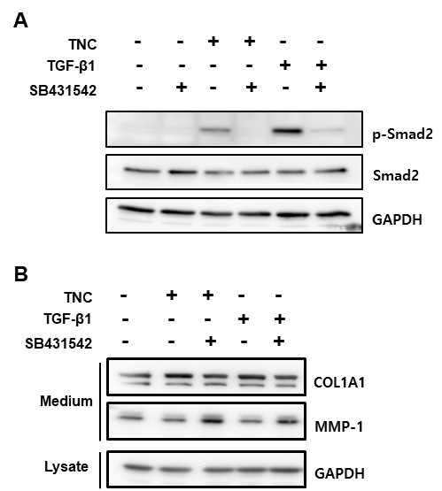 Analysis of the involvement of the TGF-β receptor in TNC-induced Smad2 phosphorylation and secretion of type I collagen and MMP-1 in fibroblasts. Sub-confluent foreskin fibroblasts were starved for 12 h. Cells were preincubated with SB431542 (10 uM), and stimulated with TNC (2 ug/ml) or TGF-β1 (3 ng/ml) for 90 min. The cell lysates were analyzed by 9% SDS-PAGE and western blotting with phospho-Smad2, Smad2,and GAPDH antibodies. (B) Serum-starved human foreskin fibroblasts were stimulated with TNC (2 ug/ml) or TGF-β1 (3 ng/ml) in the presence of SB431542 (10 uM) for 24 hr. Cell lysates were analyzed by western blotting with COL1A1, MMP-1, and GAPDH antibodies