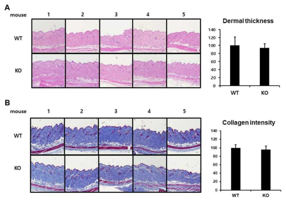 Analysis of dermal thickness and collagen intensity in skin tissues of Tnc knockout and wild type mice. Formalin-fixed and paraffin-embedded sections of skin tissues of Tnc knockout (KO) and wild type (WT) mice were deparaffinized and stained with hematoxylin and eosin (A) and Masson’s trichrome (B). The dermal thickness and collagen intensity were quantified using image J software and represented as graphs. N=5