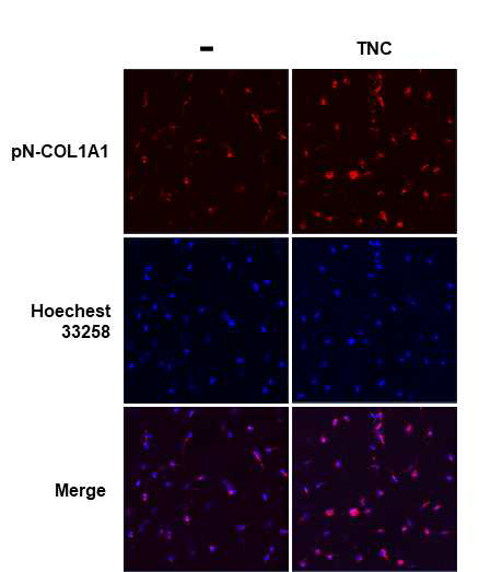 Effect of TNC on secretion of type I collagen in 3D culture of fibroblasts Foreskin fibroblasts were embedded within a three-dimensional (3D) type I collagen matrix with or without TNC (2 ug/ml). After polymerization for 1 h at 37°C, cells embedded in collagen matrix were incubated in serum-free DMEM for 24 h. The 3D matrix containing foreskin fibroblasts was stained with COL1A1 antibody and Rhodamine Red-X secondary antibody, and Hoechst 33258 for nuclear staining. Cells were analyzed by confocal fluorescence microscopy (x 200)