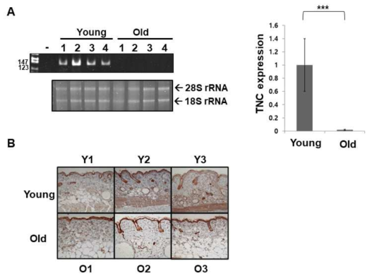 Analysis of TNC expression in young and old skin tissues of mice. (A) The mRNA level of the Tnc gene was analyzed by RT-PCR in mouse skin tissues. A graphical representation of the Tnc gene expression quantified using Multi-gauge densitometry software is shown. The values are presented as mean ± SD. ***P<0.001. -: no DNA as a negative control. (B) Immunohistochemistry (IHC) analysis of TNC on young and old mouse skin tissues. Serial sections of skin fixed with formalin and embedded in paraffin were deparaffinized and incubated with TNC antibody, followed by peroxidase-conjugated rabbit anti-goat IgG. The reactivity was developed with the peroxidase substrate 3-amino-9-ethylcarbazole (AEC). Then, the tissues were counterstained with hematoxylin. Magnification, x 200