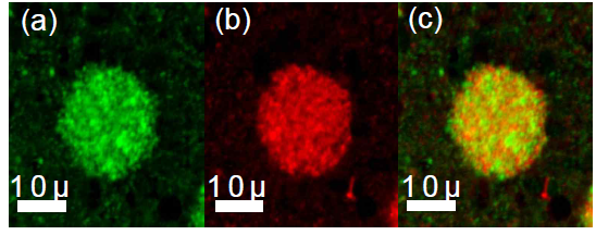 MVL의 confocal microscopy 이미지 (a) 친수성 표지자 (BODIPY® 492/515) (b) 지질 표지자(Rhodamine-DHPE) (c) 합쳐진 이미지