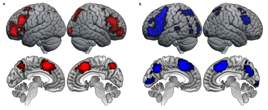 MKDA를 통해 일관적으로 활성화 되는 뇌 영역을 밝힌 것으로, (a) 귀납적 추론과 관련되어 활성화 되는 뇌 영역이다. (b) 연역적 추론과 관련되어 활성화되는 뇌 영역이다