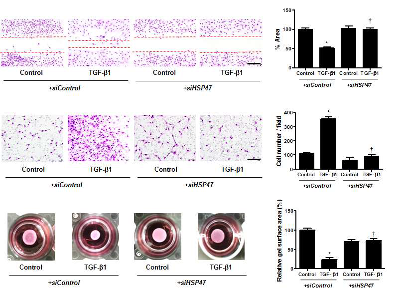 HSP47이 세포의 이동, 세포의 침습, 콜라겐 젤 수축에 미치는 영향