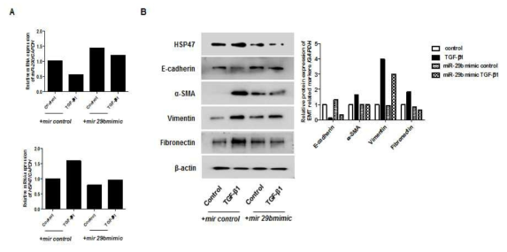 mir 29가 HSP47 및 상피중간엽이행에 미치는 영향