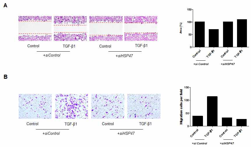 HSP47이 세포의 이동, 세포의 침습에 미치는 영향
