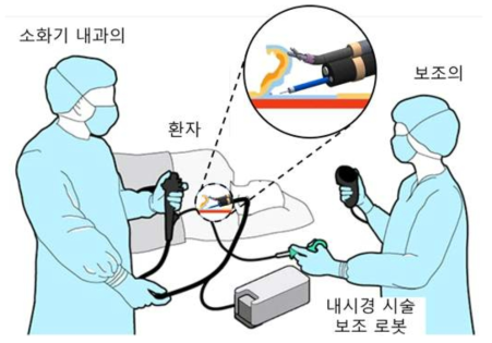 개발한 로봇팔 (PETH)를 이용한 내시경 점막하박리술 수행 예시