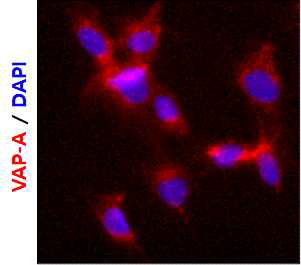 형광염색을 통한 근육줄기세포에서 VAP-A의 발현 확인