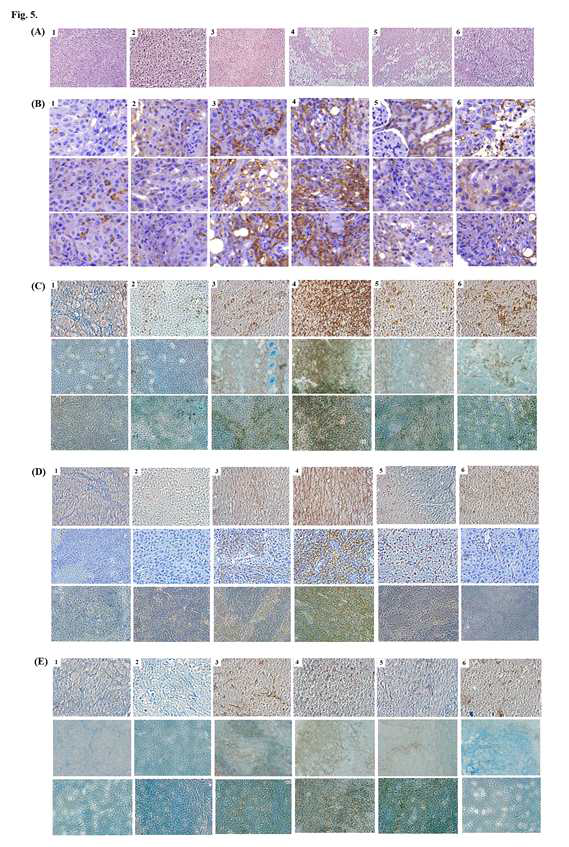 다양한 파지 및/또는 GM-CSF로 처리된 마우스로부터의 종양 조직에서 면역 세포의 면역조직화학적 분석