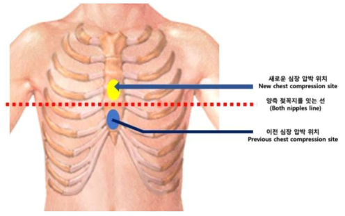 새로운 심장 압박 위치 제안