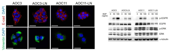 분리된 AOC 세포주의 특성 규명 (E-cad의 발현 및 EGFR 신호전달체계의 활성) - 선행연구