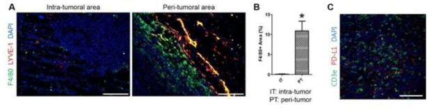 면역염색과 형광촬영을 통한 종양미세환경 시각화, (A-B) 종양의 내부와 비교하였을 때 변연부에 대식세포 및 림프관의 분포가 많음을 확인, (C) 종양내부의 CD3양성 T세포의 분포 및 PD-L1의 발현의 시각화에 성공함 - 선행연구