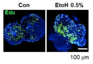 알코올 투여에 따른 오가노이드 증식 변화 - Edu staining