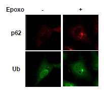 세포내 유비퀴틴 부착 응집체 형성
