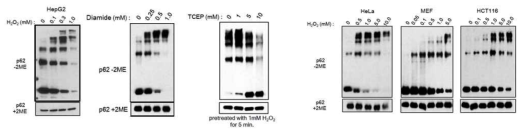4종의 세포 종에서 과산화수소 혹은 Diamide에 의한 p62 이황화 복합체 형성 및 TCEP에 의한 해소