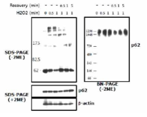 과산화수소에 의한 SDS-PAGE 상 p62 이황화 복합체 형성 및 BN-PAGE에 의한 p62 거대 단백질 복합체 분석