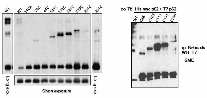 p62 내 다양한 단일 cysteine 잔기에 의해 형성되는 이황화 복합체 형성