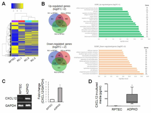 (A) 다낭신 환자의 Renal Cyst(RC) 세포의 RNA Seq (B) Up- and down-regulation 유전자들의 Gene Ontology(GO) 분석 (C) CXCL12의 RT-PCR을 통한 mRNA 발현양 조사 (D) 세포 배양액에서 CXCL12의 양을 ELISA 분석