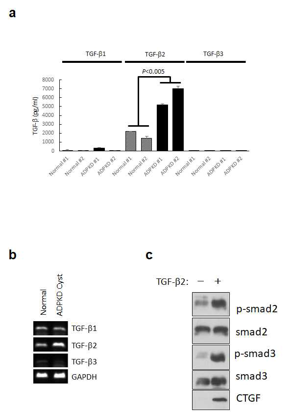 (A) 낭종 세포에서 TGF-β2가 분비됨 (B) RT-PCR로 TGF-β2의 mRNA 발현양이 증가함 (C) TGF-β2를 낭종 세포에 처리한 경우 smad 신호전달체계를 활성화시켜 섬유화를 일으키는 CTGF를 발현함