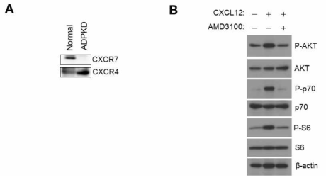 (A) 다낭신 환자의 신장 조직에서 CXCL12의 receptor인 CXCR4와 CXCR7 단백질 발현양 조사 (B) CXCR4 antagonist인 AMD3100을 처리한 경우 CXCL12와 mTOR 신호전달체계의 관계