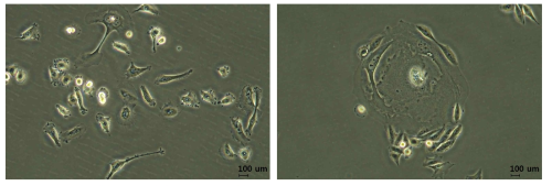MDA-MB231 WT(좌), Doxorubicin 내성 세포(우)의 광학 현미경 이미지
