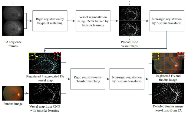 개발 기법의 개념도. 1) 우선 형광조영동영상FA의 프레임들을 특징점 정합(keypoint matching)으로 강직정합(rigid registration)한 후, CNN을 이용하여 추출된 혈관을 기반으로 비강직정합(non-rigid registration)을 수행하여 정합함. 정합 과정을 통해 FA 프레임들의 모든 혈관을 하나의 프레임으로 통합하고, 2) 유사한 강직-비강직 정합 과정을 통해 FA의 혈관을 안저영상으로 정합하여 안저영상의 혈관 정보를 추출함