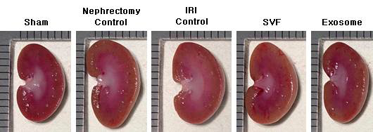IRI 동물모델 제작 및 SVF, Exosome 투여 14일 후 적출한 신장