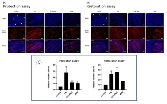 ruxolitinib을 IFN투여전 처리한 모낭기관 배양- 모낭면역특권 붕괴의 뚜렷한 예방효과를 확인