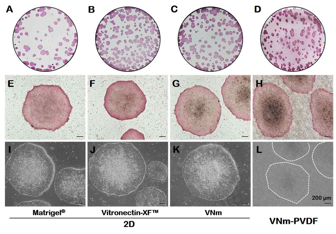 vitronectin유래 펩타이드(VNm)이 코팅된 배양기 혹은 PVDF스케폴드에서 인간 배아줄기세포의 배양 및 기존 세포외기질과의 배양 성능 비교