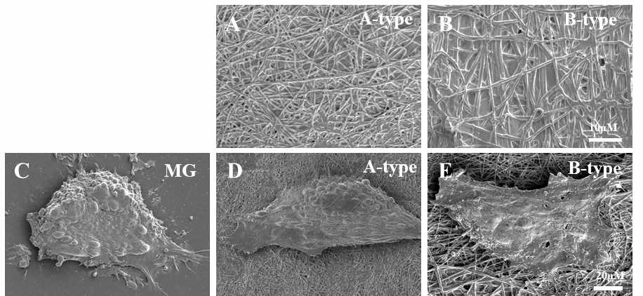 (A-B) VNm-PVDF 스케폴드의 형상에 대한 전자현미경 사진, (C-E) VNm-PVDF 스케폴드위에 부착하여 자라고 있는 인간 전분화능줄기세포의 모양