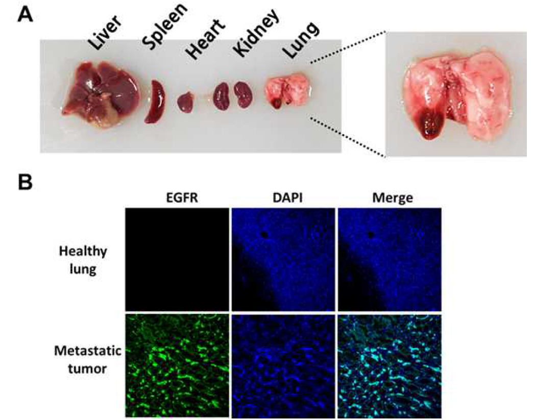 EGFR 과발현 암세포를 정상 쥐(nude mouse, 수컷)에 정맥주사한 후 30일 뒤 적출한 전체 장기 및 폐 이미지(A); 폐의 종양 발생부위 및 정상 폐에 대한 EGFR 면역염색 (immunostaining) 결과(B)