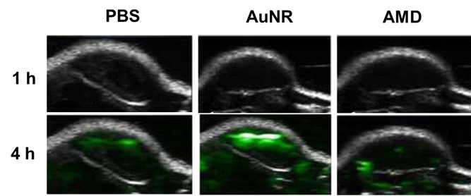 PBS, 금 나노로드(AuNR)와 AMD의 광음향 진단 효능 비교 결과