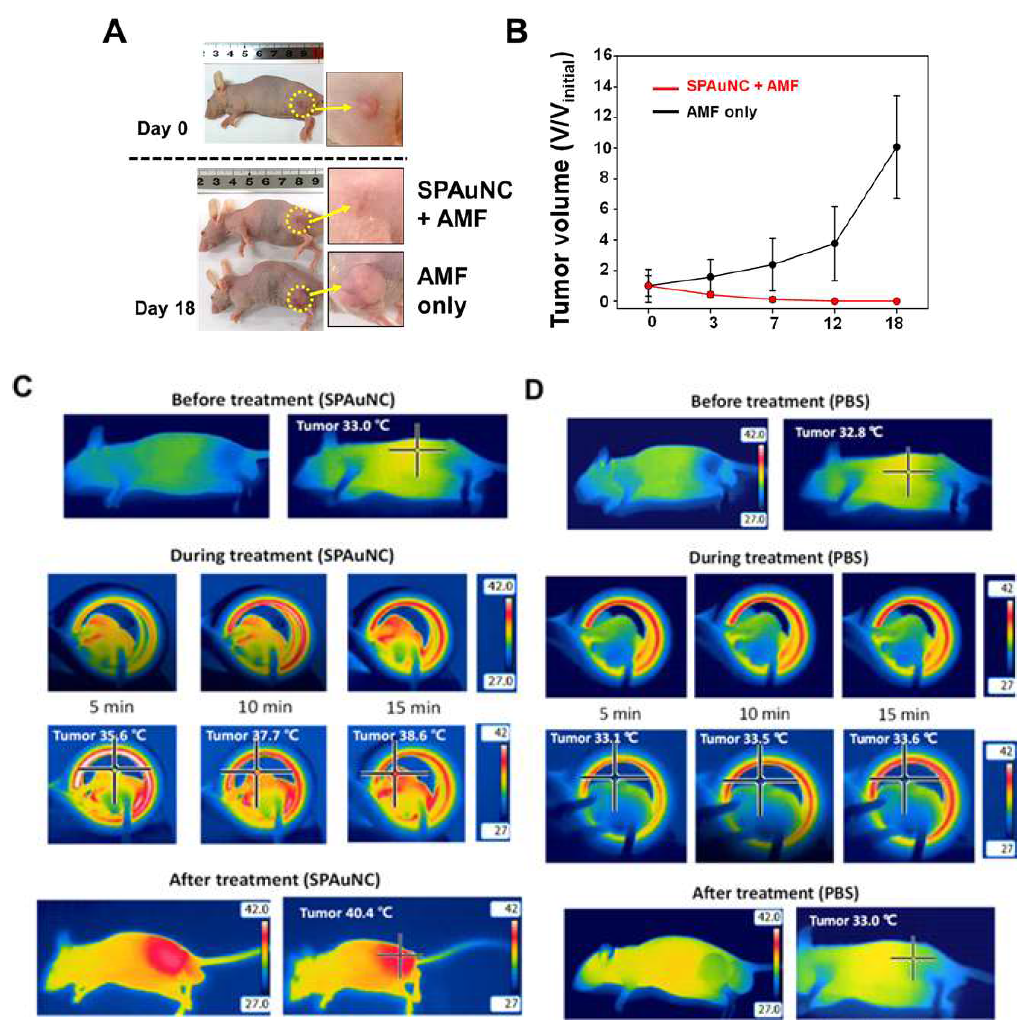 EGFR 과발현 삼중음성유방암 세포주가 피하에 이식된 동물모델(BALb/C nude mouse, 수컷, 암 크기: 300 ± 20 mm3)에 SPAuNC를 정맥주사 한 후 교류자기장을 처리한 경우(A-a)와 교류자기장만 처리한 경우(A-b)에 대해 처음과 18일 후에 대한 암 이미지 및 암 크기를 정량한 그래프(B); A-a(C)와 A-b(D)의 교류 자기장 처리 과정을 시간에 따라 열화상 카메라로 촬영한 결과