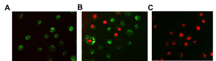 EGFR 과발현 삼중음성유방암 세포주(MDA-MB-468) 배양액에 AMD 처리 없이 근적외선 레이저를 조사하거나(A) AMD를 처리한 후 근적외선 레이저를 5분(B) 또는 20분(C)간 적용한 경우에 대해 Live/Dead 이중 염색을 수행한 결과