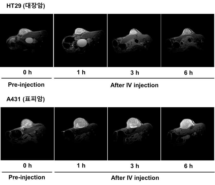 EGFR 과발현 대장암 (HT29) 및 표피암 (A431)이 피하에 이식된 동물 모델(BALB/C nude mouse)에 SPAuNC를 정맥주사 후 교류 자기장 하에서 MR 이미지 촬영한 결과