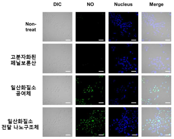 공초점 현미경으로 진행한 세포 내부에서의 일산화 질소 발생 평가 (파란색: 세포의 핵, 초록색: 일산화 질소로 인한 DCF-DA의 형광)