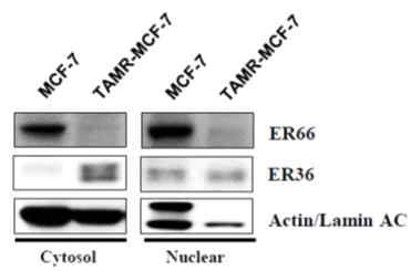 ER36 및 ER66 발현 변화