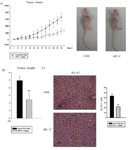 TAMR-MCF-7 세포 이식 누드마우스에서 AR-C의 항암효과